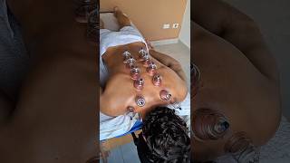 🛑ASMR🛑 Sports massage and cupping for a model. #sportmassage #relax