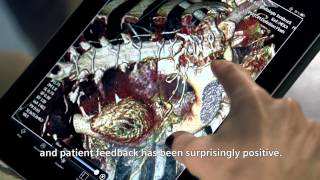 Radiology on the go with syngo.via WebViewer mobile app screenshot 2