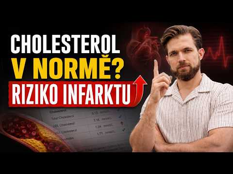 Tohle číslo rozhoduje o infarktu. Lékař ti ho nezměří