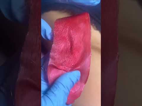 Underarm Waxing Using