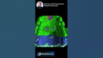 Simplify TAD Planning With Maxilla Auto Segmentation and BlueSkyPlan Guide!