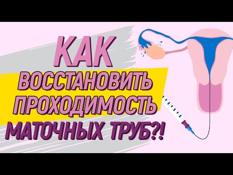 Как ВОССТАНОВИТЬ проходимость маточных труб? 🤔