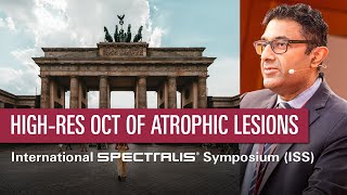 High-Resolution OCT Imaging of Atrophic Lesions Associated with AMD – SriniVas Sadda | ISS 2023