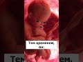 Хочу рожать 😂 Когда ребенок не торопится рождаться 👶🏻