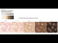 Use The Monk Scale for illustrating light to dark skin tones.