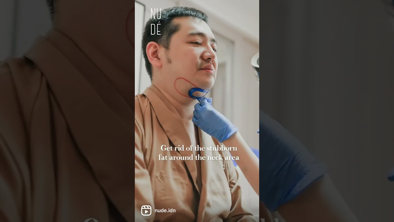 Hilangkan Lemak Membandel Permanen dengan Coolsculpting - Stubborn Fat