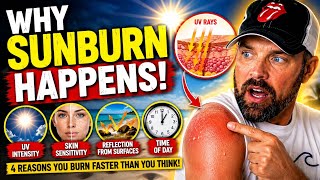 ☀️🔥 Why You Keep Getting Sunburned (It’s Not Heat) 