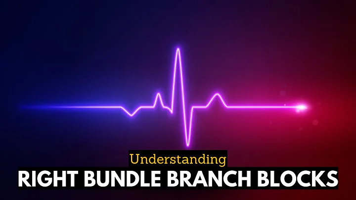 RBBB Uncovered: Navigating the Complexities of Right Bundle Branch Blocks