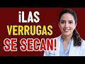 Las verrugas y papilomas DESAPARECEN SOLAS cuando haces esto en casa | Dr. Castillo