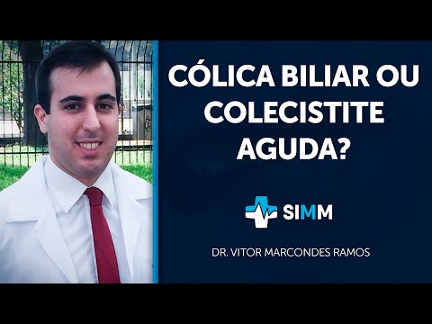 Vídeo: Cálculo Da Vesícula Biliar Com Colecistite Aguda: Sintomas E Muito Mais