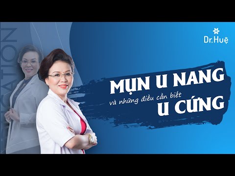 Mụn u nang u cứng là gì nguyên nhân và những điều cần biết