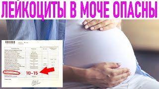 ЛЕЙКОЦИТЫ В МОЧЕ ВО ВРЕМЯ БЕРЕМЕННОСТИ | Повышенные лейкоциты в моче при беременности