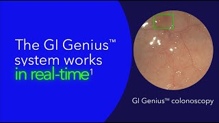 GI Genius™ in 30 Seconds: Enhanced Detection with AI