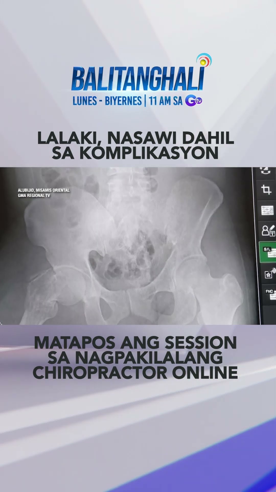 Lalaki, nasawi dahil umano sa komplikasyon matapos sumailalim sa chiropra... #shorts | Balitanghali