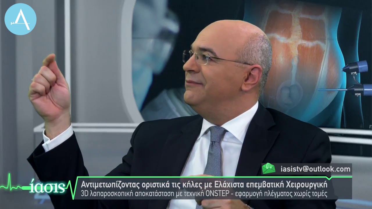 Ελάχιστα Επεμβατική Αποκατάσταση βουβωνοκηλών με την τεχνική OnStep