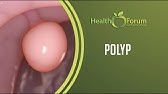 Breast Lump Cured By Sour Prune Wine Anti Cancer Guyabano Wine Nagamot Ang Bukol Sa Suso Youtube