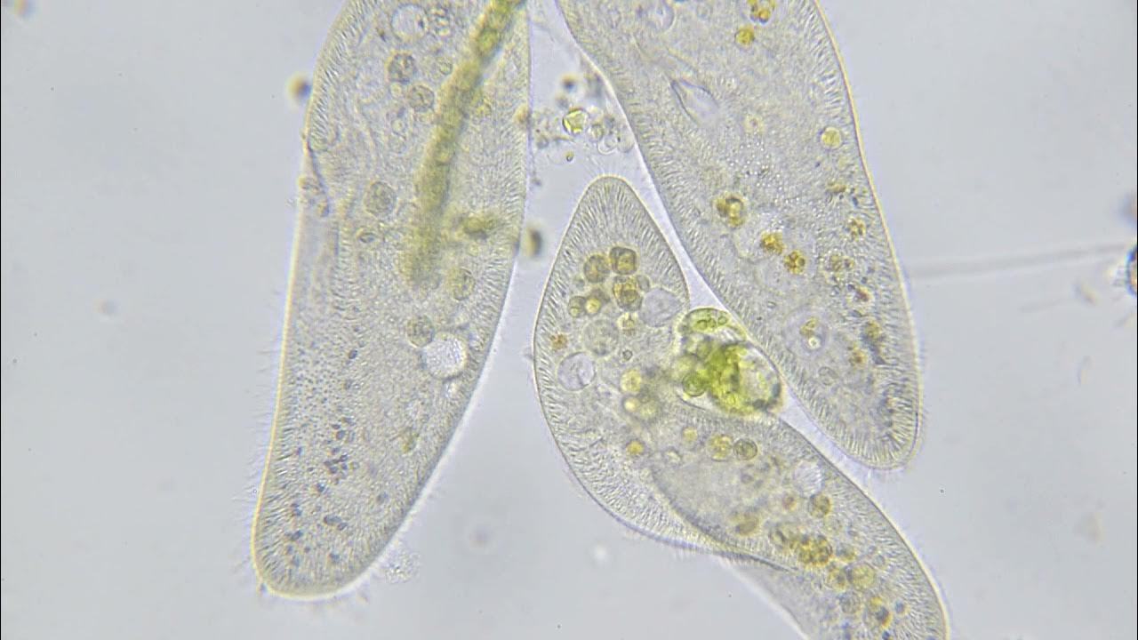 ゾウリムシが好きなボツリオコッカス YouTube