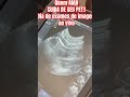 Exames #trioparadafofura #luludapomerania #cachorro #pets #viralata #cachorros #petsengraçados #ca