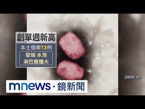 13本土+2境外 猴痘新增15例創單週新高｜#鏡新聞