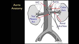 Aorta Ultrasound - Introduction - SonoSite, Inc.