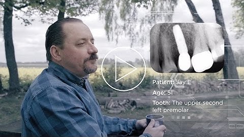 Atlantis single tooth restoration – The story of Jay  (with subtitle)