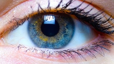 Save Your Life with an Eye Exam