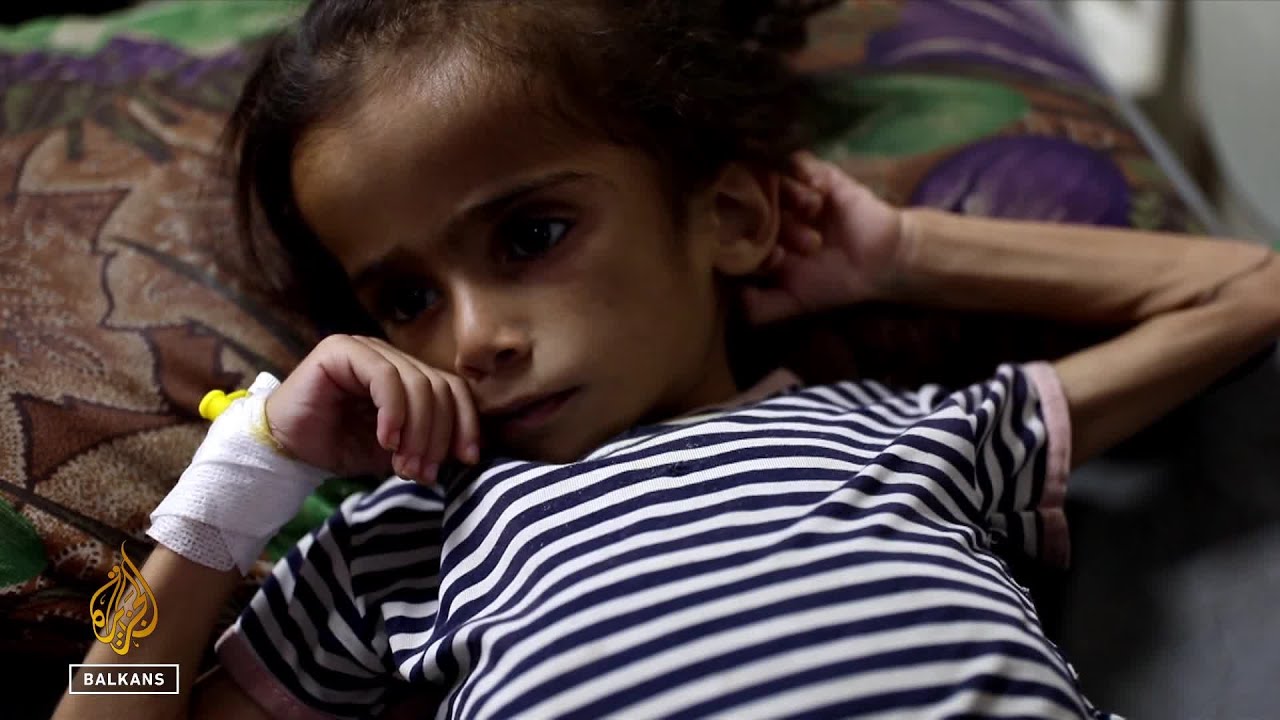 يموت أطفال غزة بسبب سوء التغذية