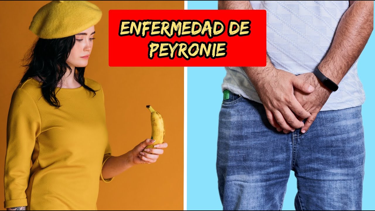 Incurvacion del Pene o Enfermedad Peyronie