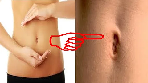 O que fazer para parar de sangrar o umbigo?