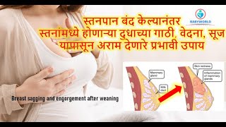 स्तनांमध्ये होणाऱ्या दुधाच्या गाठी वेदना सूज यापासून अराम देणाऱ्या टिप्स | Milk Ducts | Breast Pain