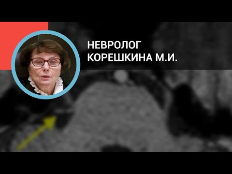 Невролог Корешкина М.И.: Дифференциальная диагностика головных болей