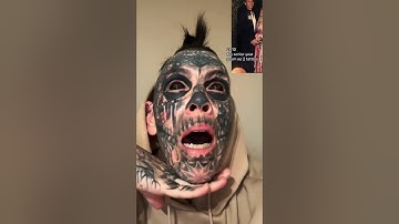 How to remove EYEBALL TATTOOS #tattoos #tattoo #tatts