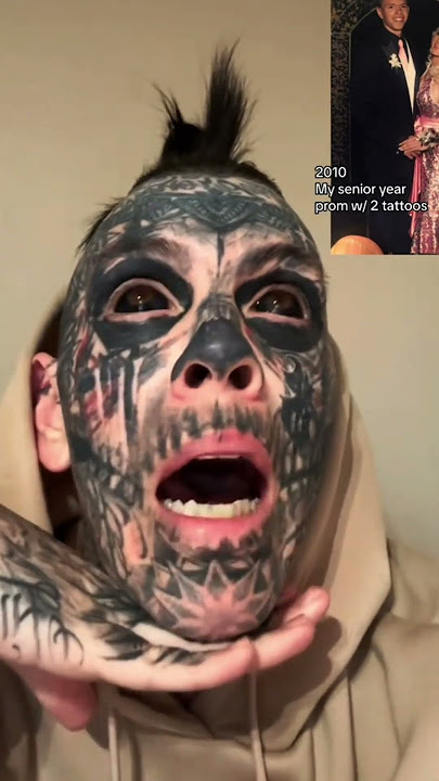 How to remove EYEBALL TATTOOS #tattoos #tattoo #tatts