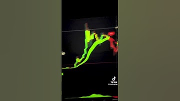 #1 Trading Algo #shorts