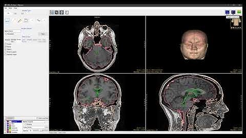 Analyze 14.0 - Measure: 3D Selected Object
