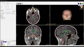 Analyze 14.0 - Measure: 3D Selected Object