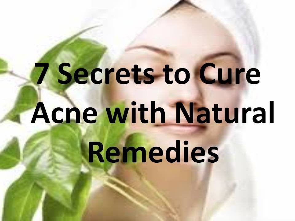 Acne Treatment at Home for Oily Skin with Natural Remedies - YouTube