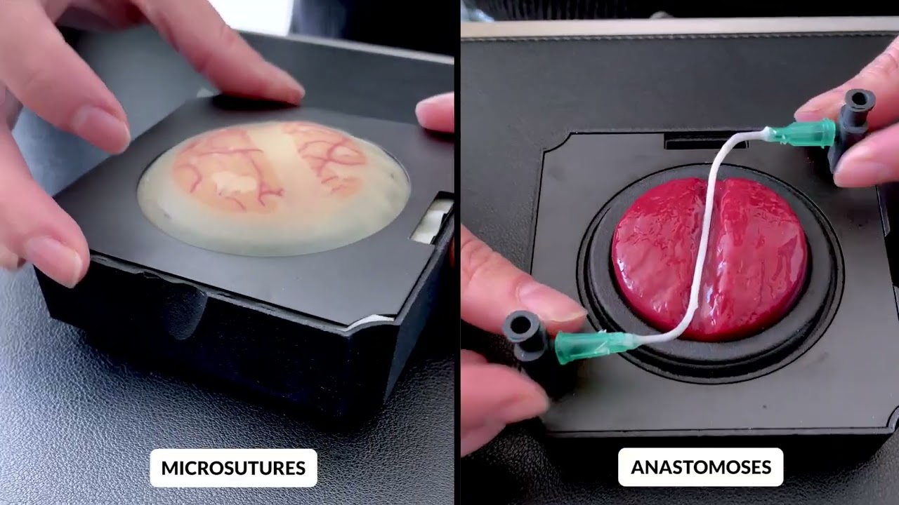 UpSurgeOn video thumbnail