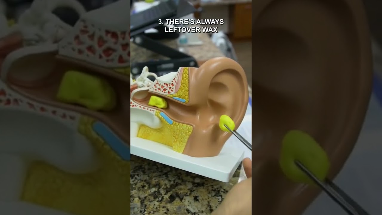 5 причин ПРЕКРАТИТЬ использовать свечи для ушей!! 🛑✋🏼