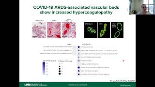 From Bedside to Bench Using Spatial Analysis