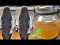 🔶CRECE TU CABELLO EN TAN SOLO 3 DÍAS CON ACEITE DE ALFALFA!! trata la caída del cabello