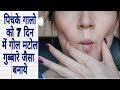 7 दिन में पिचके गालो को गोल मटोल सुंदर बनाये | Beautiful Skin | Skincare Routine | Get Chubby Cheeks