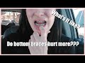 What it like getting braces on the bottom? Does it hurt more? spoiler: IT DOES!!!