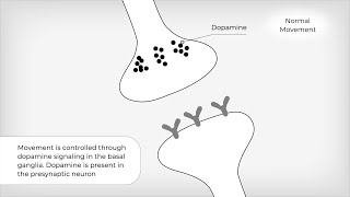 TD: Mechanism of Disease