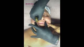 Tacoma waxing hair removal sugaring hair removal