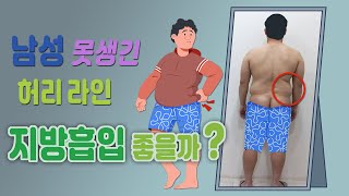 남성 못생긴 허리라인 - 지방흡입이 좋습니다