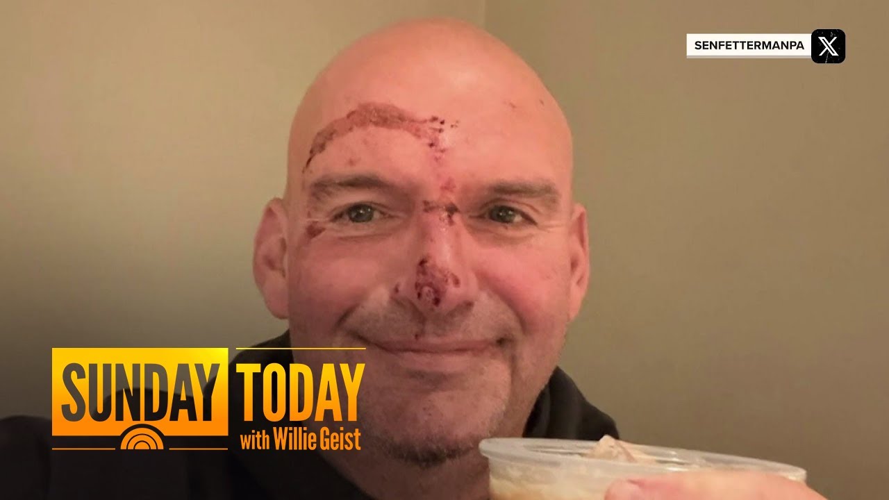 Fetterman Returns Home After Cardiac Episode Led to Fall