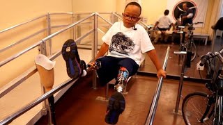 Prosthetist Makes Customized Artificial Limbs For Children Of All Economic Means Behind Every Lifelike Prosthesis Is A Prosthetist Making A Difference