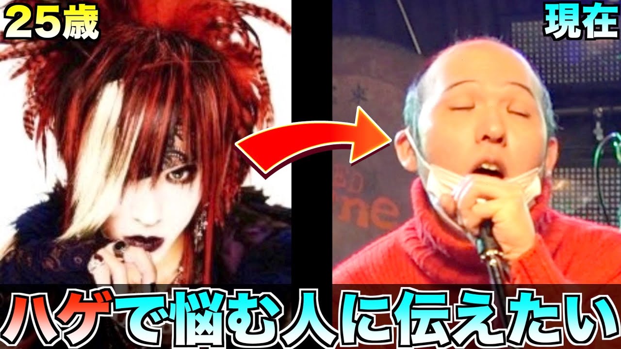 ハゲ回】世界一ポジティブな元V系ハゲ！女性に○○と言われてハゲを
