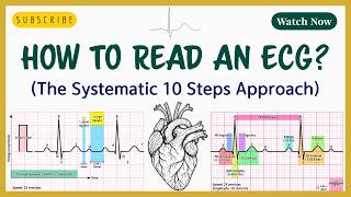ECG Interpretation Made Easy | Step-by-Step Guide for Medical Students & Doctors